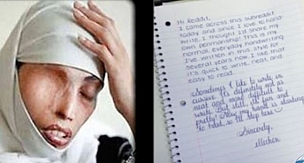 HİKAYE VAKTİ - Annemin Tek Gözü 