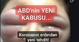 Koronavirüsün ardından yeni kabus! Doğa intikam mı alıyor... 